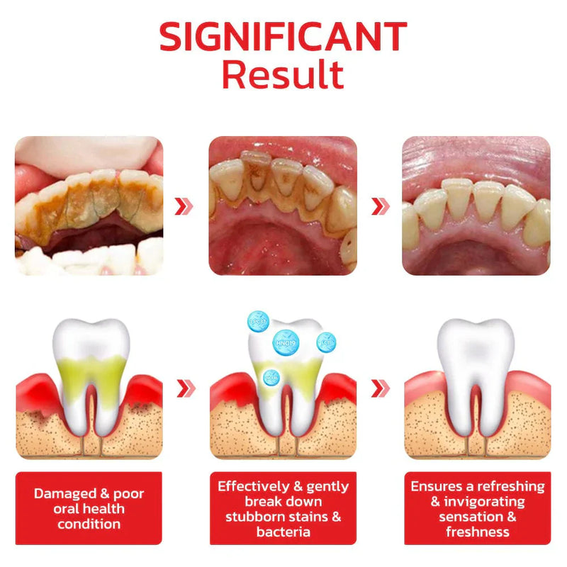 BrightenUp™ - SP-4 Ultra+ Teeth Whitening Toothpaste ✨🦷 (Buy 1 Get 1 Free 🔥🔥)