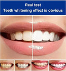 BrightenUp™ - SP-4 Ultra+ Teeth Whitening Toothpaste ✨🦷 (Buy 1 Get 1 Free 🔥🔥)