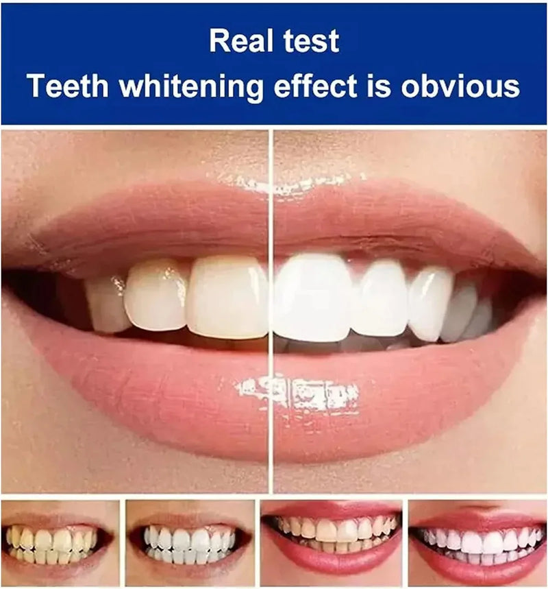 BrightenUp™ - SP-4 Ultra+ Teeth Whitening Toothpaste ✨🦷 (Buy 1 Get 1 Free 🔥🔥)