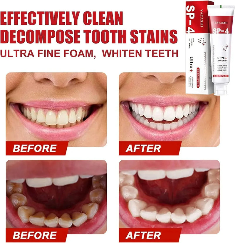 BrightenUp™ - SP-4 Ultra+ Teeth Whitening Toothpaste ✨🦷 (Buy 1 Get 1 Free 🔥🔥)